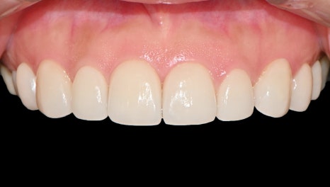 63c7a660ebf63307b4a850008cd4a86d_1775122139_5254.jpg 63c7a660ebf63307b4a850008cd4a86d_1775122139_5254.jpg