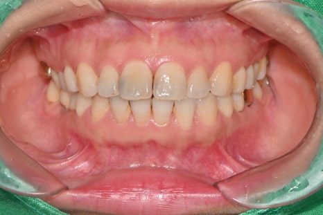 63c7a660ebf63307b4a850008cd4a86d_1775122265_2509.jpg 63c7a660ebf63307b4a850008cd4a86d_1775122265_2509.jpg