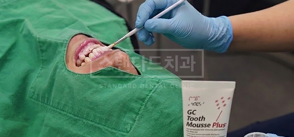 투스무스 시림 완화 케어